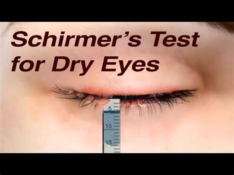 schirmer's test eye drops